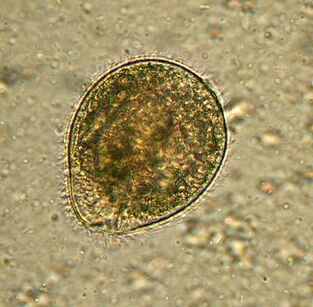 Balantidium en büyük protozoan parazittir